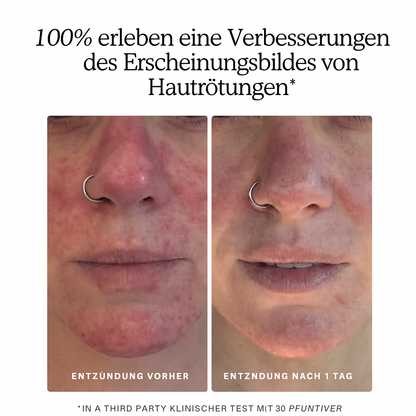 Solura Kissen-Cleanser